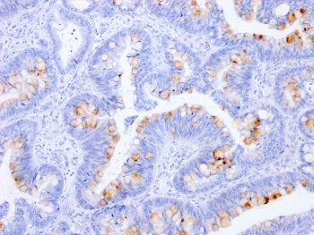 CEA Antibody / Carcinoembryonic Antigen
