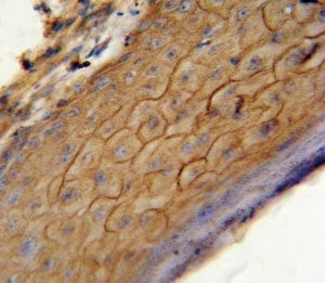 CB2 Antibody (Cannabinoid Receptor 2)