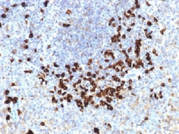 Lambda Light Chain Antibody / Lambda Antibody
