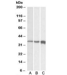 TNNT3 Antibody (Biotin Conjugate)