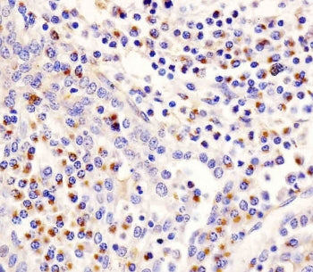PLA2G7 Antibody / Lp-PLA2 / PAFAH