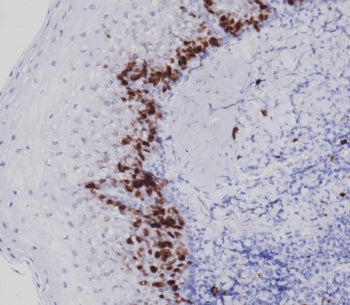 Ki67 antibody