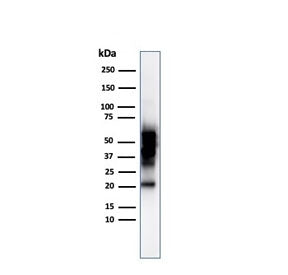 Western blot testing of human COLO-38 cell lysate using SOX10 antibody (clone SOX10/992). Expected m