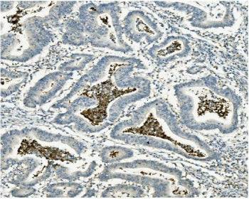 ATG4A Antibody