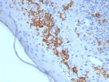 CD1a Antibody