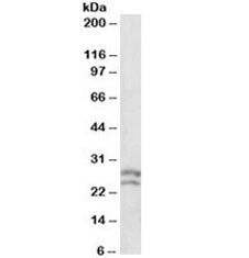 Western blot testing of human lymph lysate with BCL2 antibody at 0.1ug/ml. Expected molecular weight