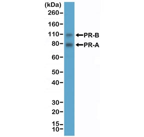 Recombinant PR Antibody / Progesterone Receptor