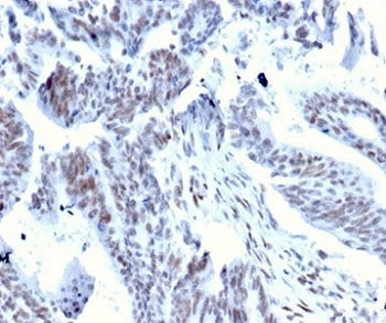 Serum Response Factor Antibody / SRF