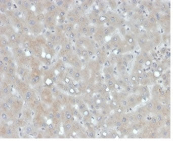 APOB Antibody / Apolipoprotein B