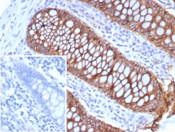 CDH17 Antibody / Cadherin 17