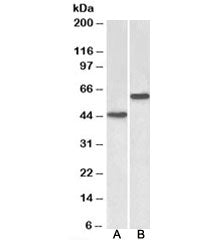 Western blot testing of human cerebellum [A] and liver [B] lysates with LYVE1 antibody at 2ug/ml. Im