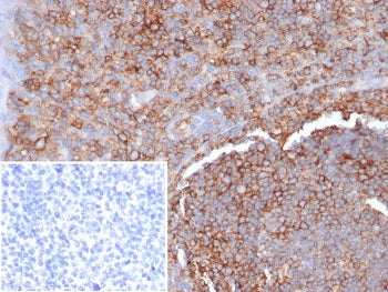 HLA-G Antibody
