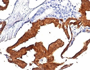 IDH1 Antibody / Isocitrate Dehydrogenase (R132H mutant)