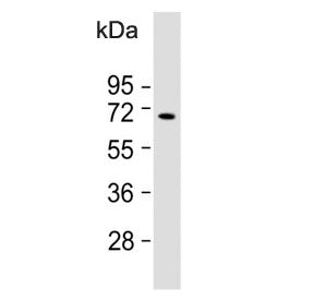 Bradykinin Antibody / Kininogen