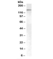 SENP6 Antibody