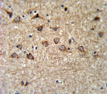 Mitoferrin-1 Antibody / MFRN / SLC25A37