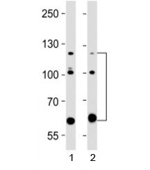 Western blot testing of ABL2 antibody at 1:2000 dilution. Lane 1: human A431 lysate; 2: human HeLa l