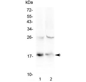 Western blot testing of 1) human HeLa and 2) mouse spleen lysate with TSLP antibody at 0.5ug/ml. Pre