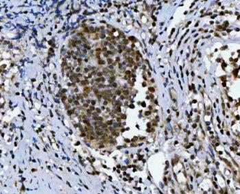 IHC staining of FFPE human tonsil tissue with TRIR antibody. HIER: boil tissue sections in pH8 EDTA 