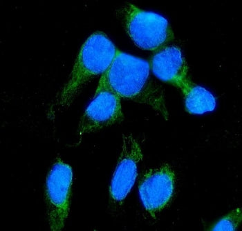 NNT Antibody / Nicotinamide Nucleotide Transhydrogenase