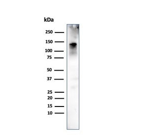 Caldesmon / CAD Antibody HMW