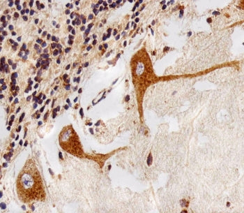 PPT1 Antibody