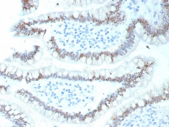 IHC staining of FFPE human colon tissue with recombinant CDX2 antibody (clone CDX2/9298R). HIER: boi