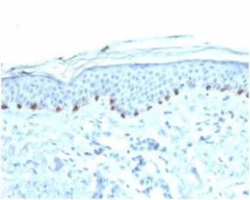 IHC staining of FFPE human skin with Tyrosinase antibody (clone TYR/3826) at 2ug/ml. HIER: boil tiss