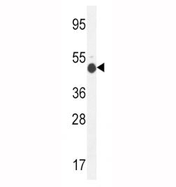 GCNT2 Antibody