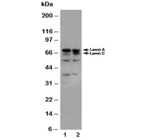 Western blot testing of Lamin A/C antibody and Lane 1: HeLa; 2: A431 cell lysate. Predicted molecula