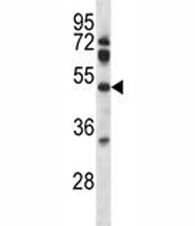 Pdk4 Antibody