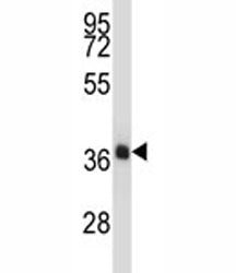 NKX2.4 antibody western blot analysis in human placenta tissue lysate