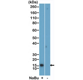 H2BK5ac Antibody / Acetyl-Histone H2B Lysine 5