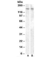 Western blot testing of human amygdala lysate with AVPR1B antibody, cat # R35132 (0.5ug/ml, lane A) 