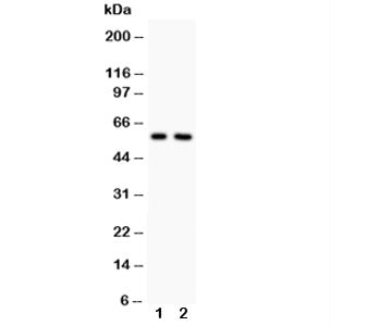 Alkaline Phosphatase Antibody (tissue-nonspecific)