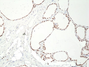 PAX8 Antibody / Paired box 8