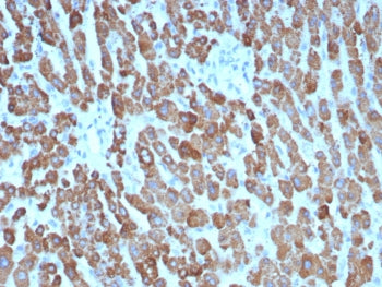 CPS1 Antibody / Carbamoyl phosphate synthetase 1