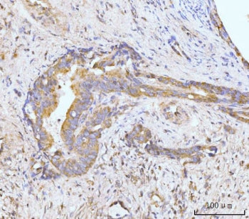 MAP4K1 Antibody / HPK1