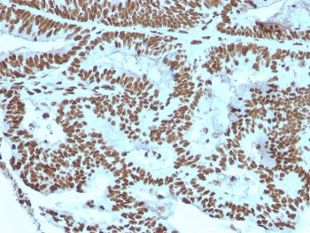 ZNF846 Antibody