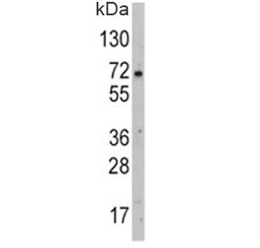 GLUT2 Antibody (SLC2A2)