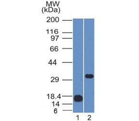 CD79b Antibody