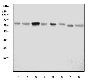 Acid Phosphatase Antibody / ACP2 (Lysosomal)