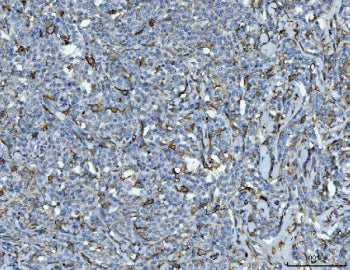 CD14 Antibody