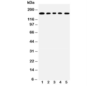 Western blot testing of MUC1 antibody and Lane 1: COLO320; 2: SW620; 3: HEPG2; 4: MCF-7; 5: Jurkat l