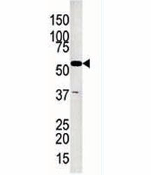 Glycerol kinase 2 Antibody (GK2)