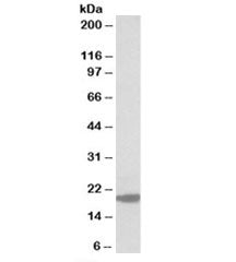 Western blot testing of MOLT4 lysate with MCTS1 antibody at 0.3ug/ml. Predicted molecular weight: ~2