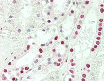 SNRPD3 Antibody / Sm-D3
