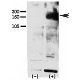 Phospho-ERBB4 Antibody (pY1162)