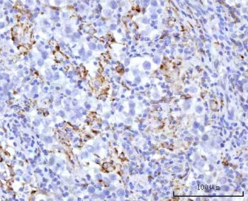 IHC staining of FFPE human testicular seminoma tissue with UBXN8 antibody. HIER: boil tissue section