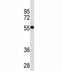 VDR Antibody